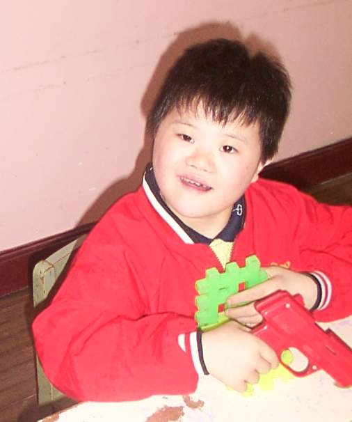 那为什么唐氏综合症的人都长了一个样子呢?图片
